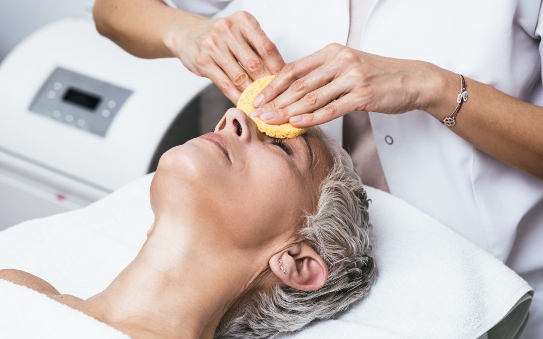 Chemical Peels: Celebrating National Peel Day