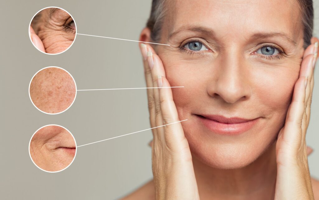 photoaging