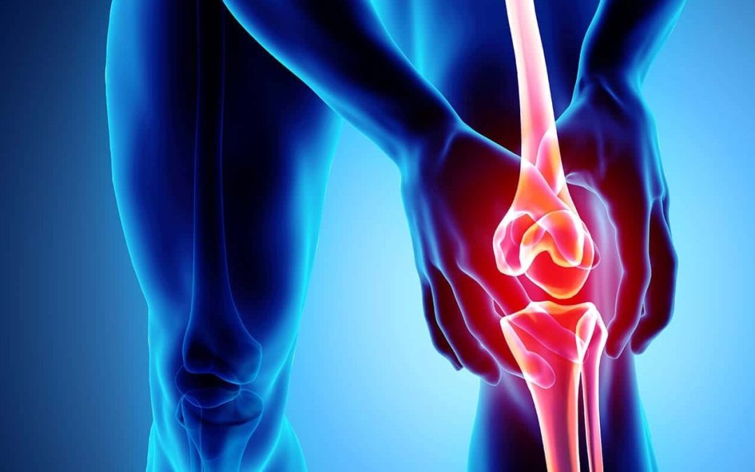 Osteoarthritis
