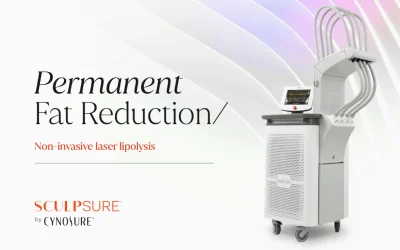 W.H.Y. Wednesday: SculpSure
